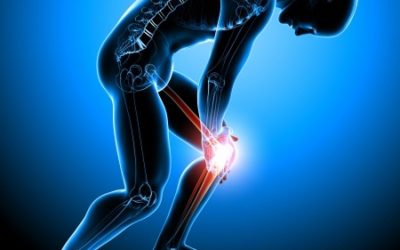 Six Ways to Relieve Arthritis Pain