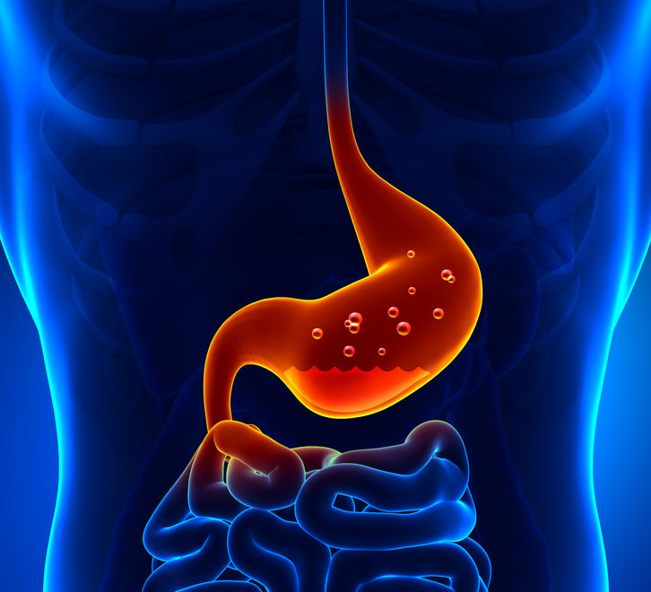 What is Erosive Esophagitis?