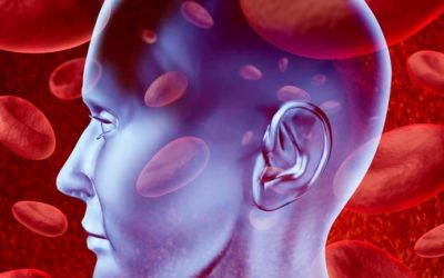 Stroke –Treatment/Ways to Reduce Your Risk!  Dr. Peter J. Rice