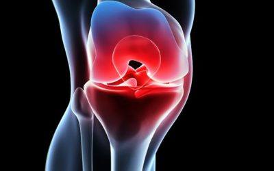 NSAIDs — Are they Helpful or Harmful? Dr. Peter J. Rice