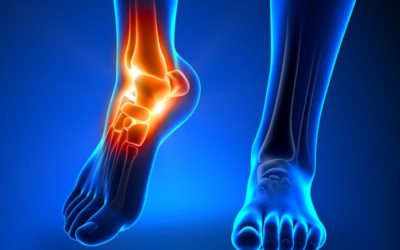 Injury Prevention — Tips to Stay Healthy