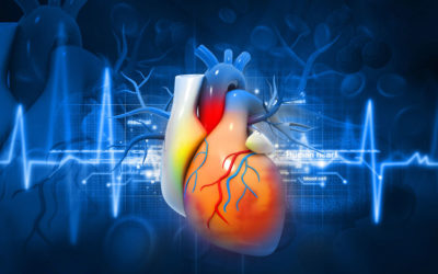 Managing fluid buildup in heart failure