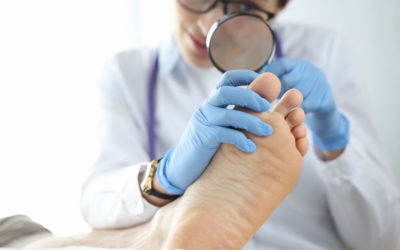 Effective Treatments for Onychomycosis (Nail Fungus)