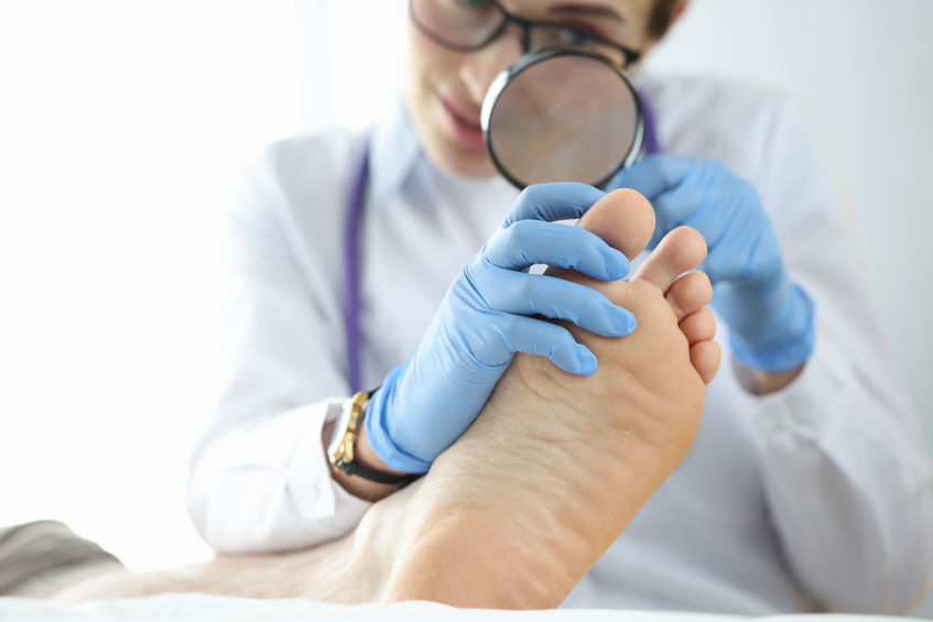 Effective Treatments for Onychomycosis (Nail Fungus)