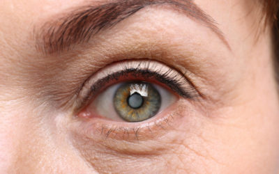 Cataracts: Is it time for surgery?