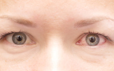 Type 2 Diabetes and its effect on Your Eyes